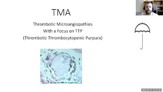 Thrombotic Microangiopathies with a Focus on TTP (Thrombotic Thrombocytopenic Purpura)