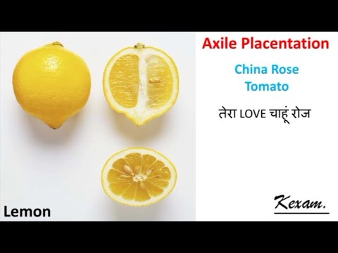 Axile Placentation Explained. NBD#1. kexam. #NEET