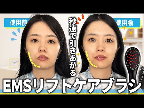 【たった１回で！？】ミュゼ史上最強美容機器がすごかった、、