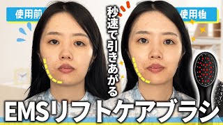 【たった１回で！？】ミュゼ史上最強美容機器がすごかった、、