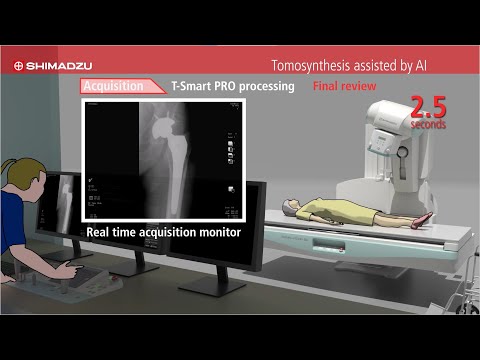 Tomosynthesis assisted by AI - Shimadzu T-smart PRO