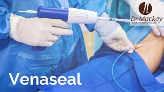 What is VenaSeal?