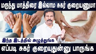 உங்களுடைய நகத்தை வச்சு உங்க ஆரோக்கியத்தை கண்டுபிடிக்கலாம்| Sugar control tips | Dr.Akshayan