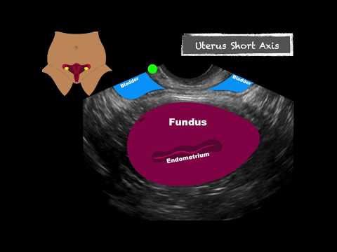 POCUS Female Pelvis Transvaginal Scanning Sequence