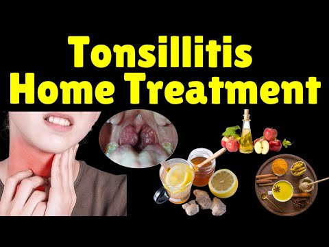 Tonsillitis Home Treatment | Tonsillitis Home Remedies | How to Treat Tonsillitis at Home