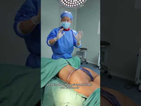 脂肪丰臀，自体脂肪丰臀，腰腹吸脂和脂肪丰臀Fat buttocks, waist and abdomen liposuction and fat buttocks.