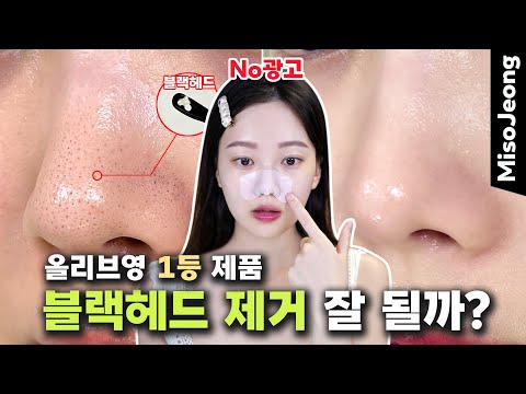 Will the No. 1 cleansing product in Korea remove blackheads well? (without Vaseline)