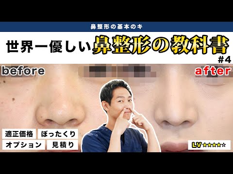 【鼻整形】ぼったくり注意！値段の相場を理解しよう　鼻整形の基本のキ＜#４＞