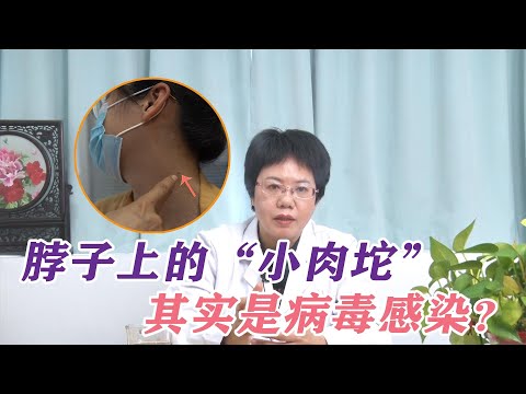 健康|生活|脖子上的“小肉坨”，还能传染给别人？来看看你有吗？脖子上的“小肉坨”，還能傳染給別人？來看看你有嗎