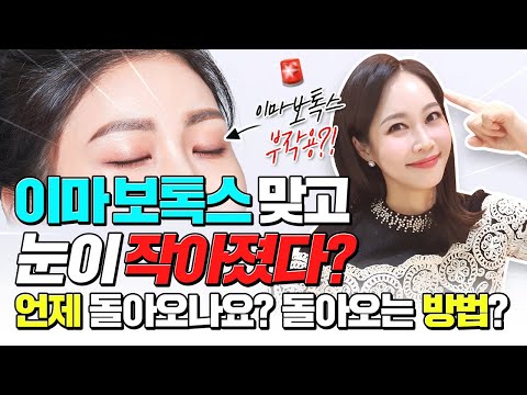 이마 보톡스 하고 눈이 작아졌다❓ '이것'만 체크하면 부작용 안생기게 이마 보톡스 가능❗ (feat.이마 보톡스 10년차 장인)