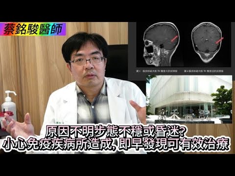 觀察者識讀原因不明步態不穩或昏迷?良醫蔡銘駿：小心免疫疾病所造成, 即早發現可有效治療