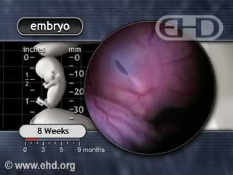 The Human Embryo Eight Weeks After Conception