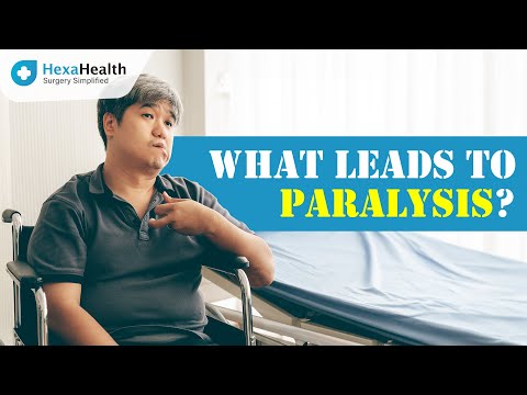 Know all about Paralysis! || HexaHealth Expert Dr. Sanjay Kumar Chaudhary