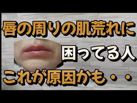 唇の周りの肌荒れに悩んでいる方は是非見てください。たくさんの人がやっているこんなことが理由かもしれません。