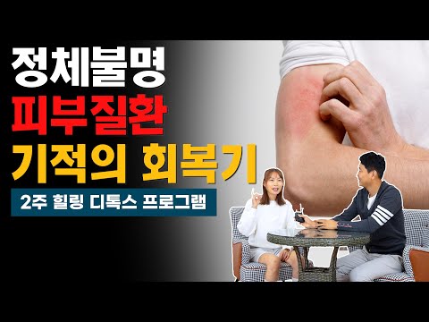 정체불명 피부질환 기적의 회복기(2주 힐링 디톡스 프로그램)