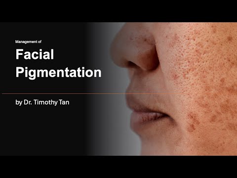 Management of Facial Pigmentation by Dr. Timothy Tan (28 June 2024)