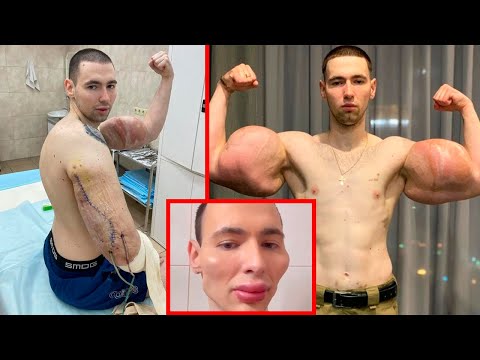 Epic Plastic Surgery Fails