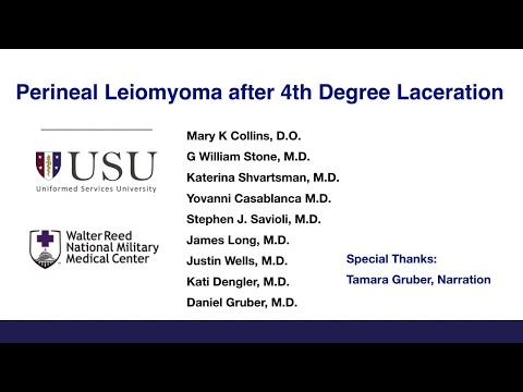 Perineal Leiomyoma after 4th Degree Laceration