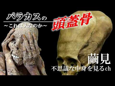 DNA検査で「亜人間」？パラカスの頭蓋骨を徹底調査！