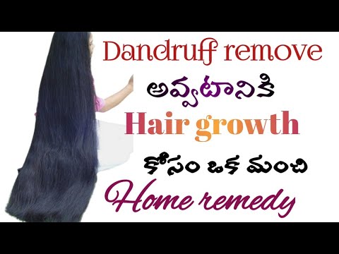 Dandruff remove అవ్వటానికి hair గ్రోత్ కోసం ఒక మంచి Home remedy// Best home remedies for hair growth