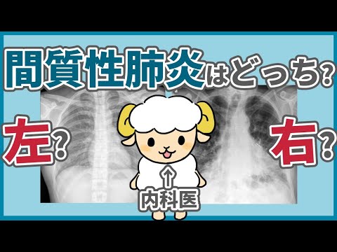 間質性肺炎のレントゲンを徹底解説【動画内で読めるようになります】