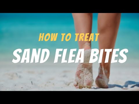 Immediate Action: How to Treat Sand Flea Bites Like a Pro