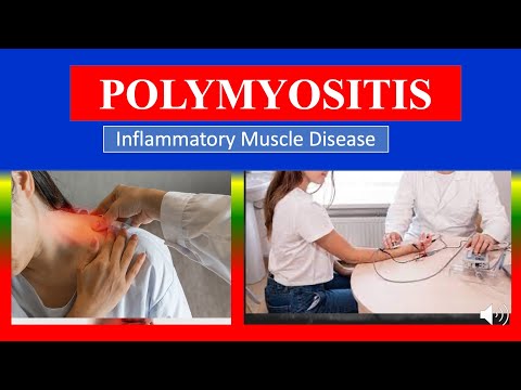 POLYMYOSITIS - Definition, types, causes, pathophysiology, symptoms , diagnoses , medicine