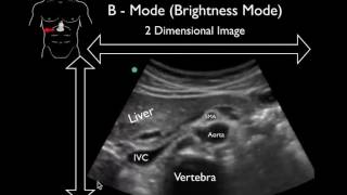 Ultrasound Physics Scanning Modes B Mode