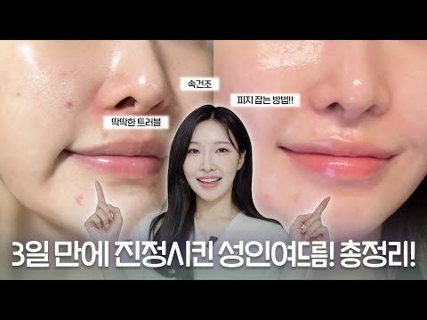 cc) 3일만에 진정‼️시킨 트러블 꿀템 영업갑니다🙆🏻‍♀️ 저도 영업당했는데요..이건찐이다. 참을수없지ㅣ아랑