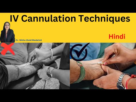 Cannula Kaise Lagate Hain | How To Insert IV Cannula | IV Cannula कैसे लगाते हैं | Cannula hataye