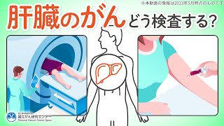 【検査】肝臓のがんはどうやって検査する？ステージはどう決まるの？肝がんの疑問にお答えします！