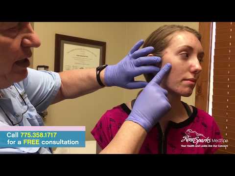 Acne Cyst Drainage Surgery for Cystic Acne - Reno Sparks MedSpa - Dr. Calvin Van Reken