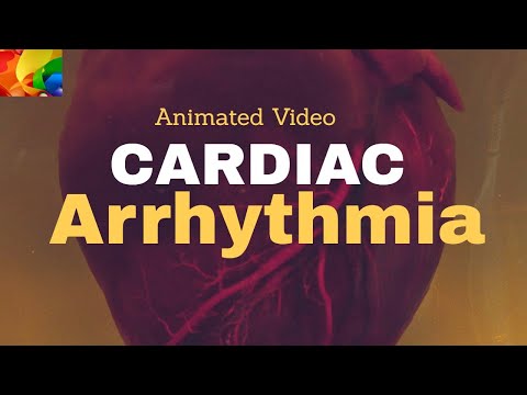 Cardiac Arrhythmia Animation Video|| Classification Of Cardiac Arrhythmia||NO COPYRIGHT GRAPHICS