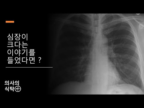 심비대 (1) 심장이 커졌다는 이야기를 들으셨다면? 심비대 : 심장초음파