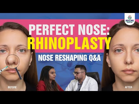 Top Rhinoplasty Questions Answered by Dr. Sumit Singh | Nose Reshaping Q&A | Healing Hospital