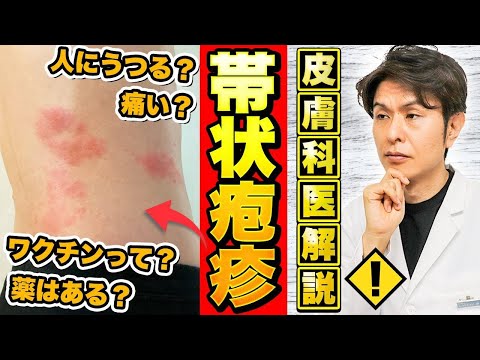 【3人に1人が発症？】帯状疱疹の原因・症状・治療法・ワクチンについて皮膚科専門医が解説【人にうつる？】