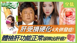 體檢肝功能正常卻揪出肝癌？ 肝臟過勞3情況是肝毒失控警訊！ 肝受損硬化 4大併發症！ 決明子清肝解毒降肝火！ 逆轉脂肪肝 青色入肝這樣吃！ 健康2.0 20220731 (完整版)