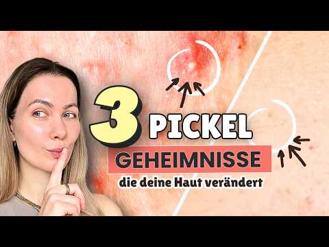 Warum deine Pickel immer wieder kommen + wie du sie ENDLICH loswerden kannst!