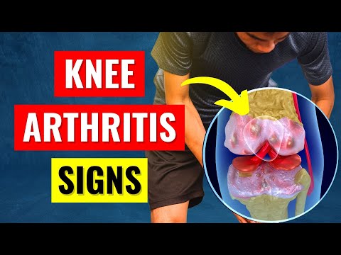 Knee Pain Arthritis Symptoms - What You Need To Know