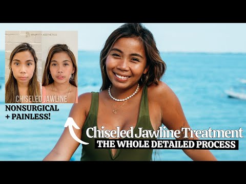 My Nonsurgical Chiseled Jawline Experience (Painless & Effective!!!)