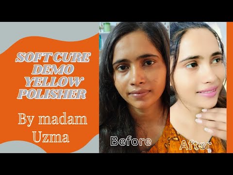 yellow polisher before after results demo video how to use step by step SOft cure by madam Uzma