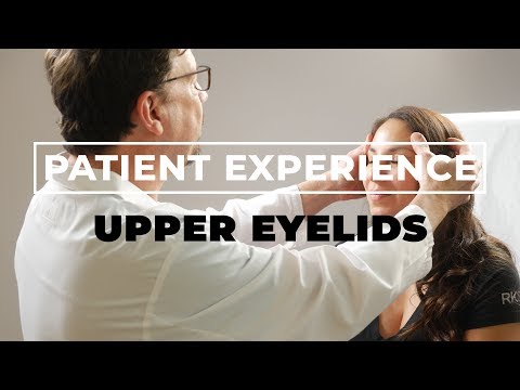 Upper Eyelid Surgery | Patient Experience