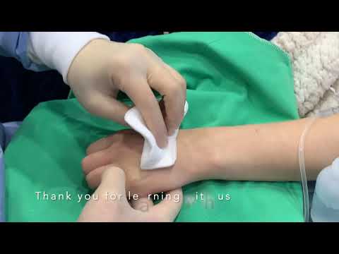 How to perfectly execute injection to the back of hands and fingers with fillers and fat. 如何將手背跟手指完美