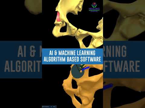 Why FT-3D Hip Replacement is Better Than Other Techniques #ft3dhipreplacement #hipsurgery #hip