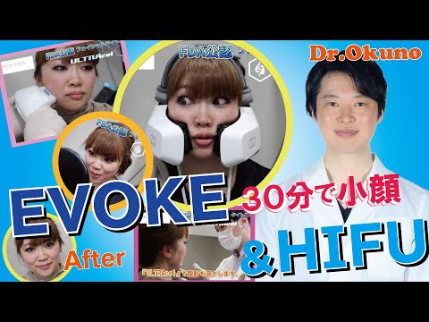 EVOKE & HIFU ULTRAcel Q+ / 頬のたる＆フェイスライン　小顔効果