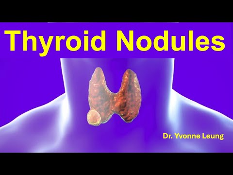 Thyroid Nodules by Dr. Yvonne Leung - 17 Feb 2023