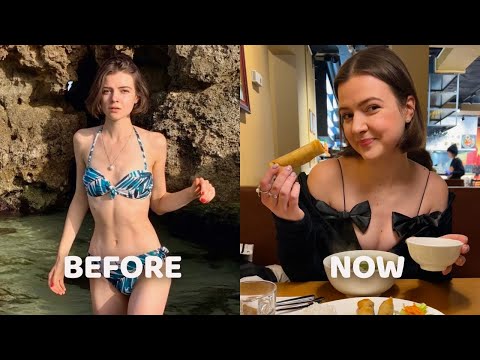 How to Lose Weight? Unveiling My Eating Disorder Story