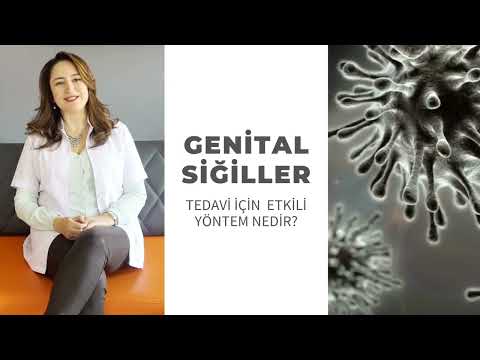 Genital Siğilde Tedavi İçin En Etkili Yöntem Nedir?