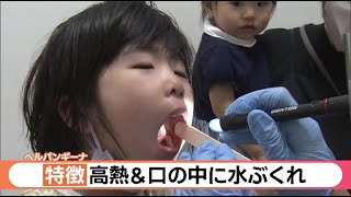 急増する子どもの発熱患者　夏風邪の一種“ヘルパンギーナ” 　ワクチン無し、主な感染経路は飛沫・接触