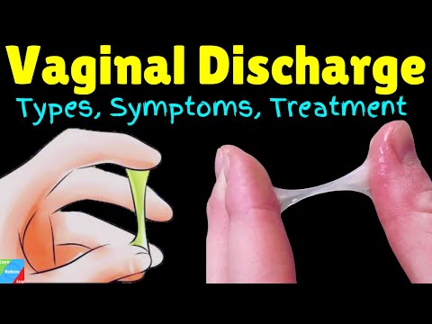 Vaginal Discharge: Types, Symptoms, Causes, Diagnosis, Treatment and Prevention